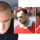 Illustration for article titled EA Sports Pioneers the In-Game Hair Transplant